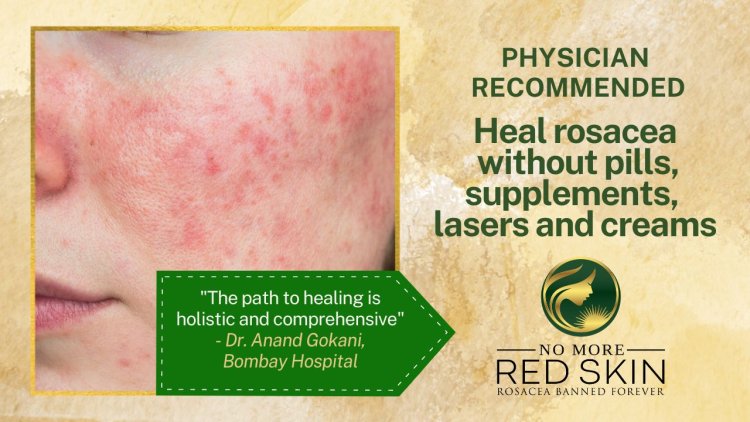 No More Red Skin: Revolutionizing The Rosacea Narrative in India