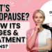 What’s Menopause? Know its stages and best treatment options?
